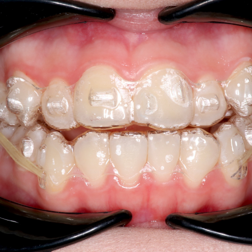 Teeth in 72 Hours image