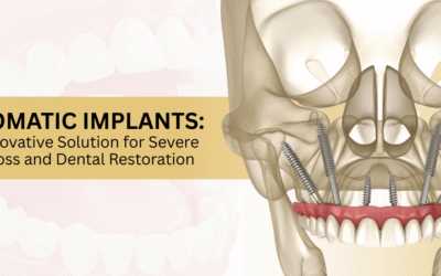 Are Zygomatic Implants a Solution for Extreme Bone Loss Cases?