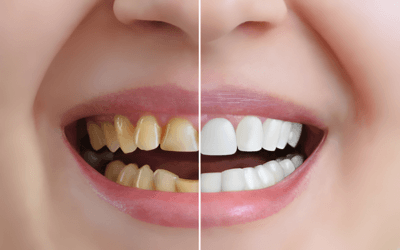 Cosmetic Dentistry