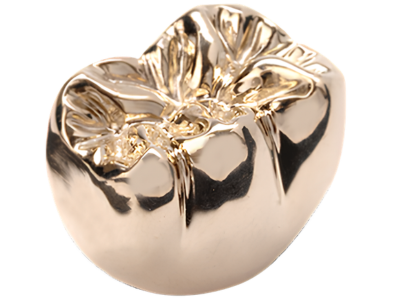 Gold dental crown with decorative petal-like engravings on top