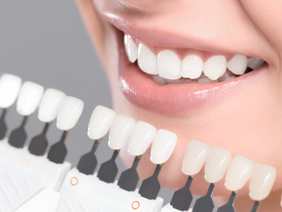 Close-up of a smiling mouth with a tooth shade guide matching color to teeth