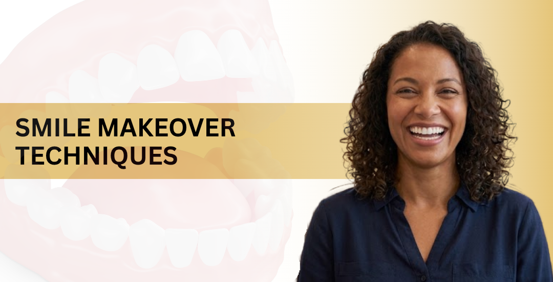 Smile Makeover Techniques
