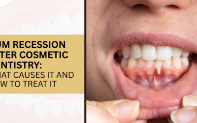 Gum Recession After Implant or Veneers — What to Do