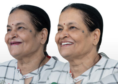 Side-by-side before-and-after view of a smiling woman showcasing dental improvement; logo reads 'Dr. Namratha' at the bottom.
