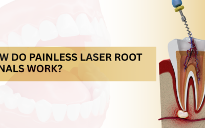 How Do Painless Laser Root Canals Work?