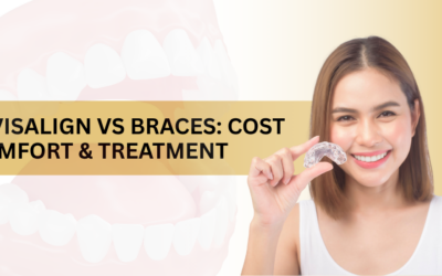 Invisalign vs Braces: Which Costs Less and Feels Better?