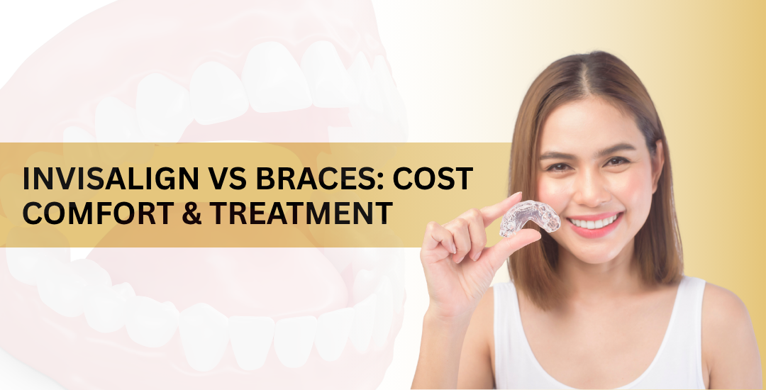Invisalign vs Braces: Which Costs Less and Feels Better?