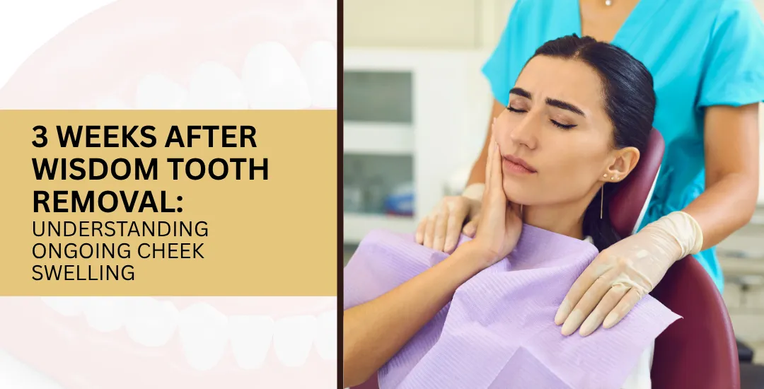 Informational graphic about cheek swelling 3 weeks after wisdom tooth removal; patient in a dental chair on the right side.