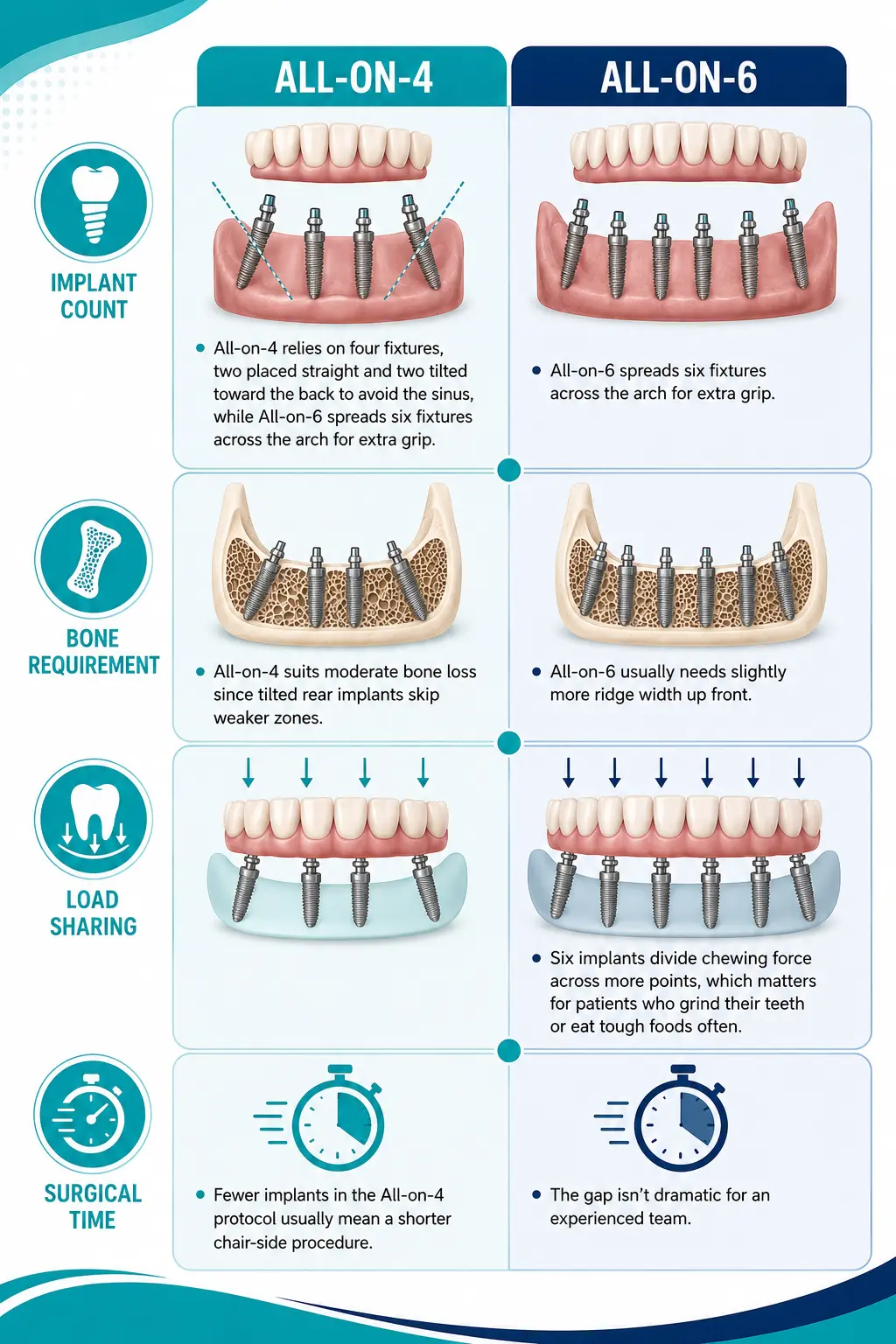 All-on-4 vs All-on-6 Dental Guide | Enamel Dental All-on-4 vs All-on-6 Dental Guide
