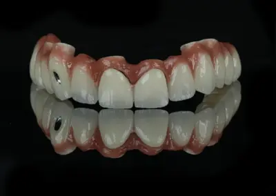 Full-arch dental prosthesis (upper denture) with pink acrylic gingiva and white teeth on a glossy black surface, reflection visible.