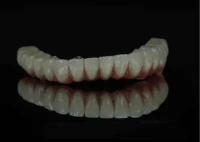 Full-arch dental prosthesis (implant-supported bridge) displayed on a black reflective surface with a slight smile curve.
