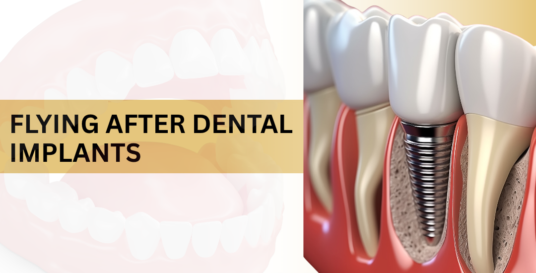 Flying After Dental Implants
