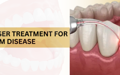 Can Laser Treatment Help Cure Gum Disease Faster?
